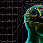 EEG Nedir, Nasıl ve Ne İçin Çekilir?
