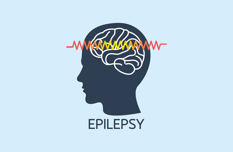 Epilepsi Genel